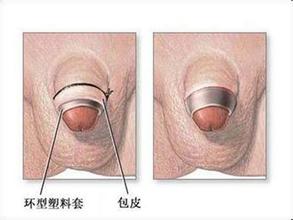 ���԰�Ƥ��ô����